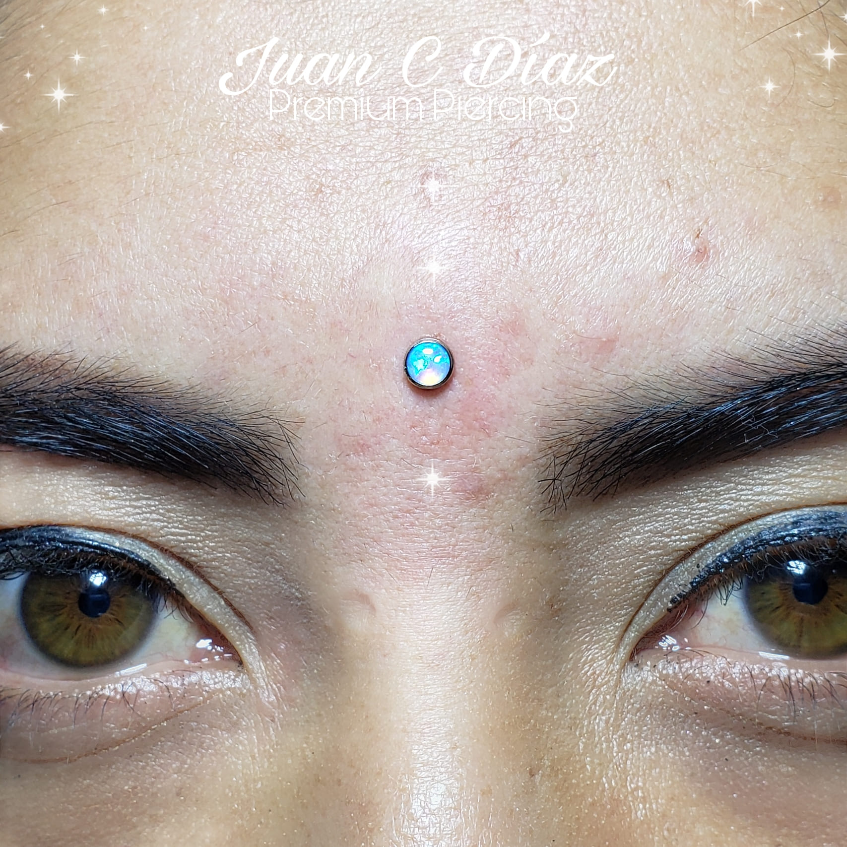 MICRODERMAL